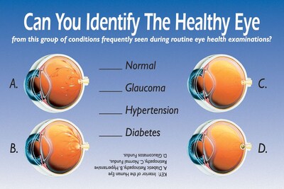 Patient Interactive Laser Postcards; Identify Healthy Eye